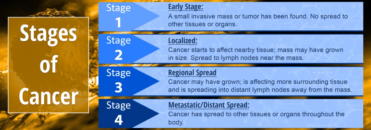 Stages of Cancer chart: Stages 1 - 4