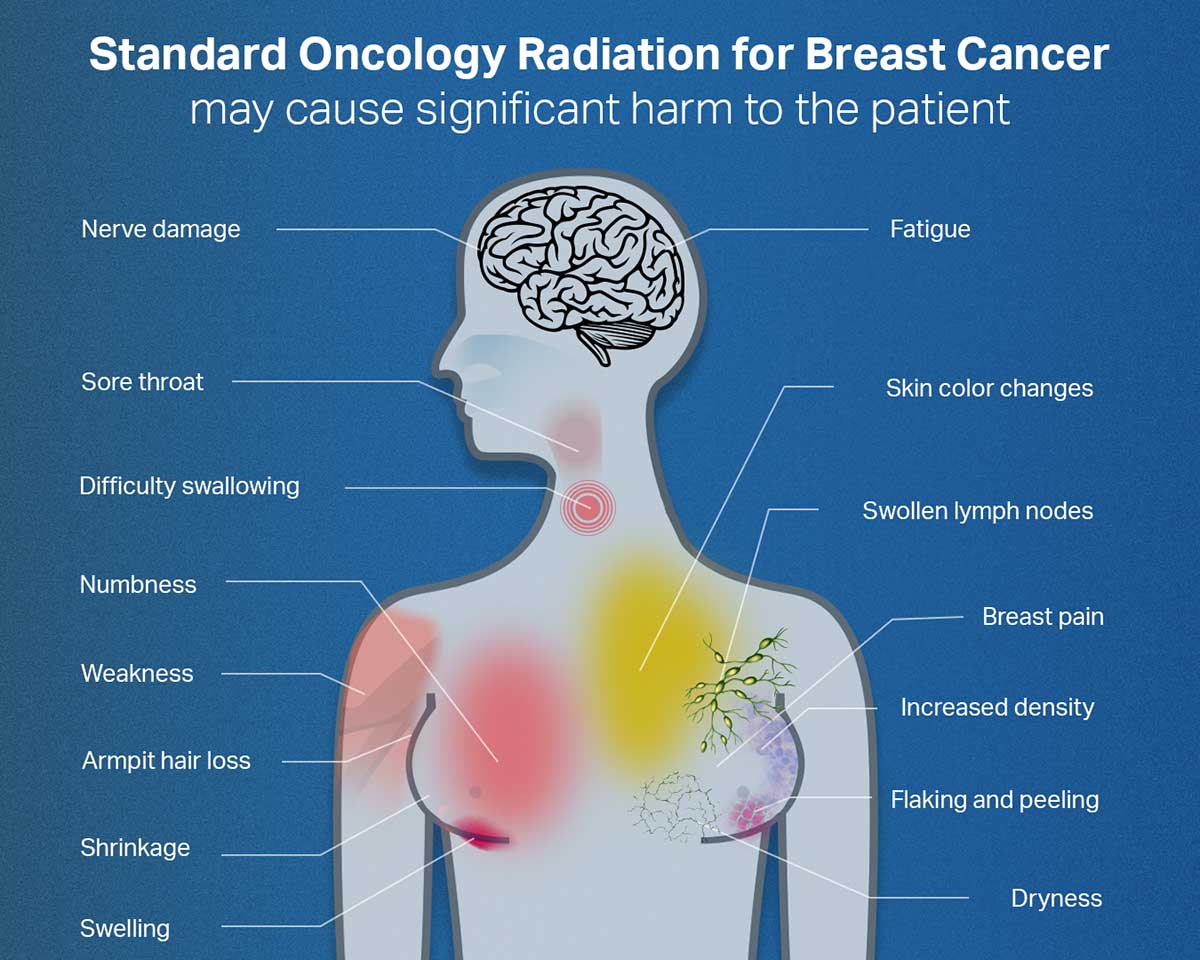 Standard Oncology Radiation diagram