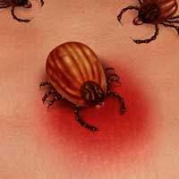 How Lyme Disease and Chronic Infections Can Lead to Cancer