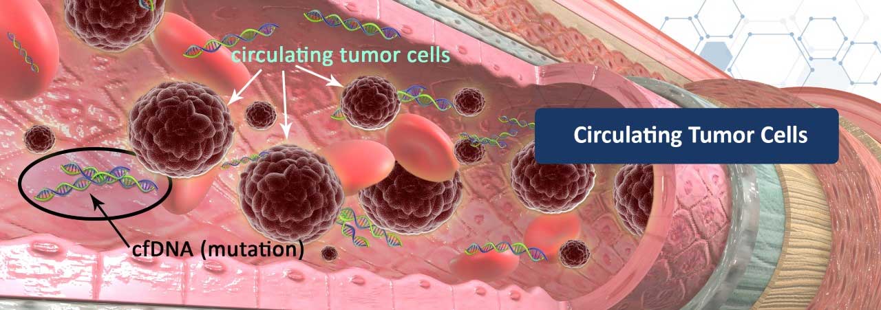 A graphical depiction of circulating tumor cells