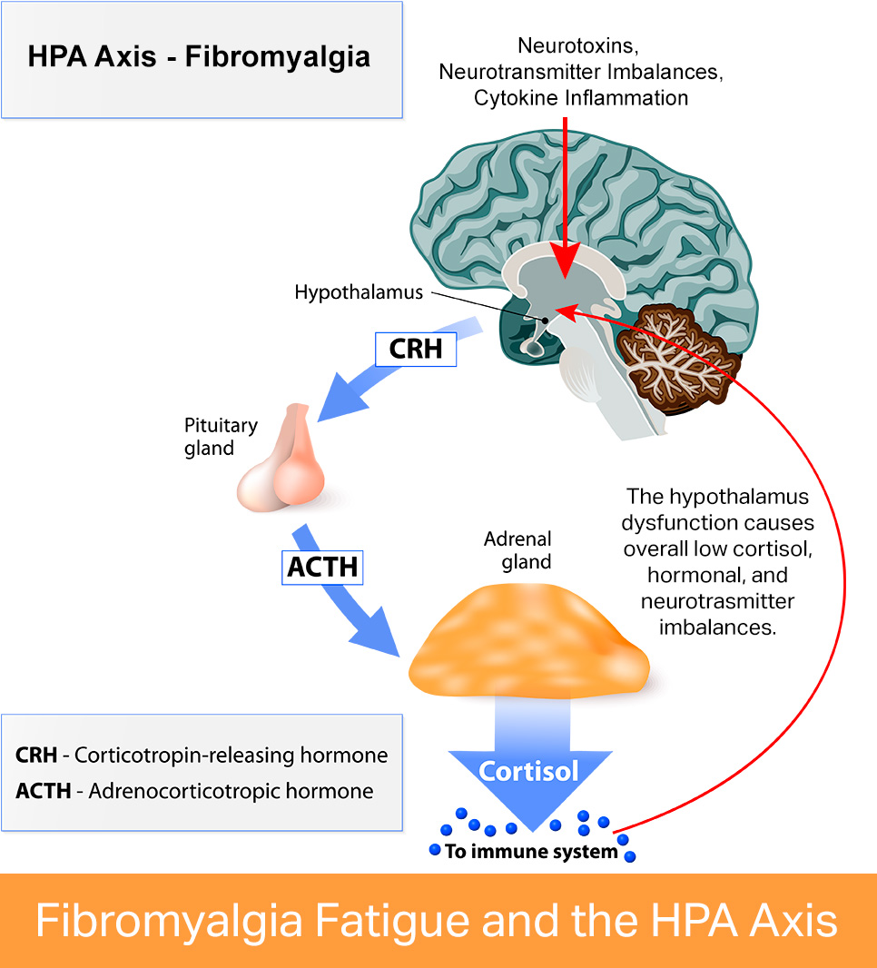 Fibromyalgia and the HPA Axis