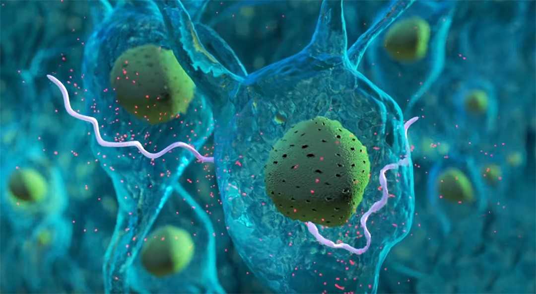 A graphical depiction of Borrelia attacking neurons in the brain