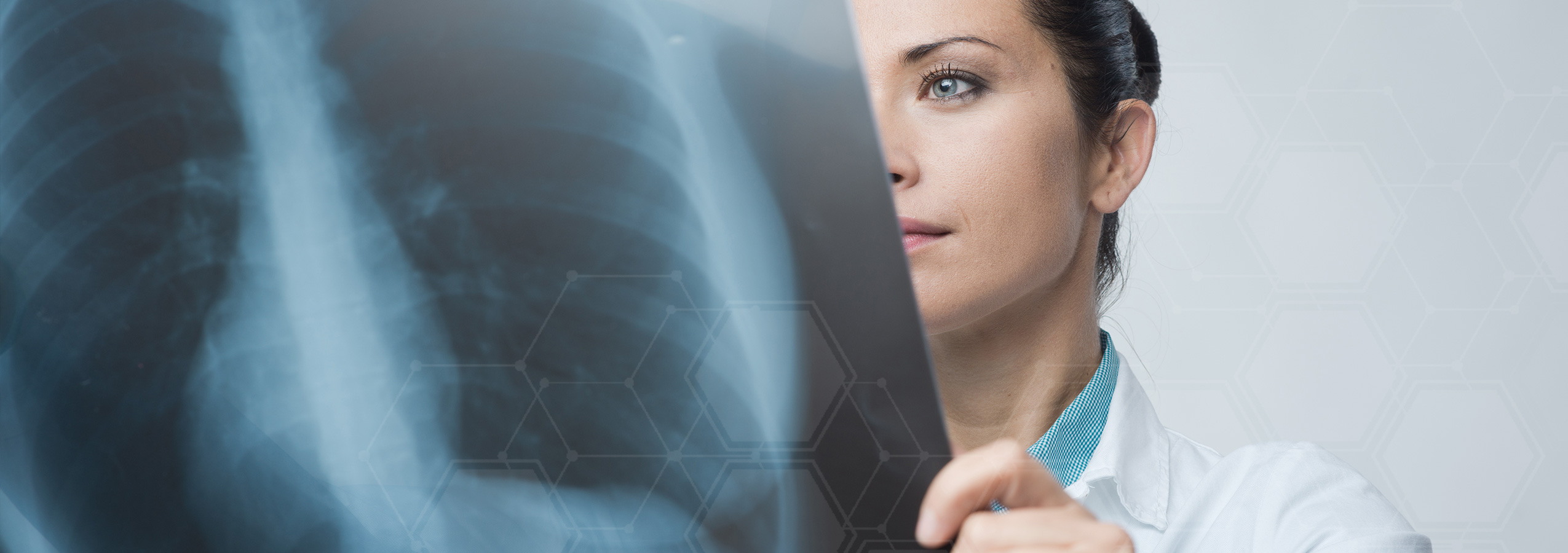 Doctor analyzing an x-ray