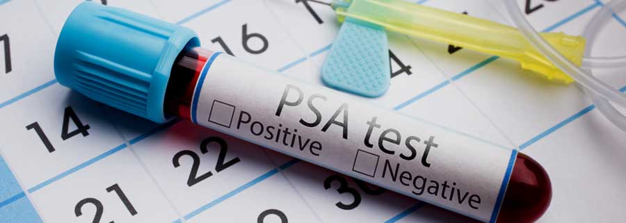 PSA test tube