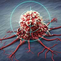 Chemotherapy and Standard Cancer Treatments Are Failing Patients