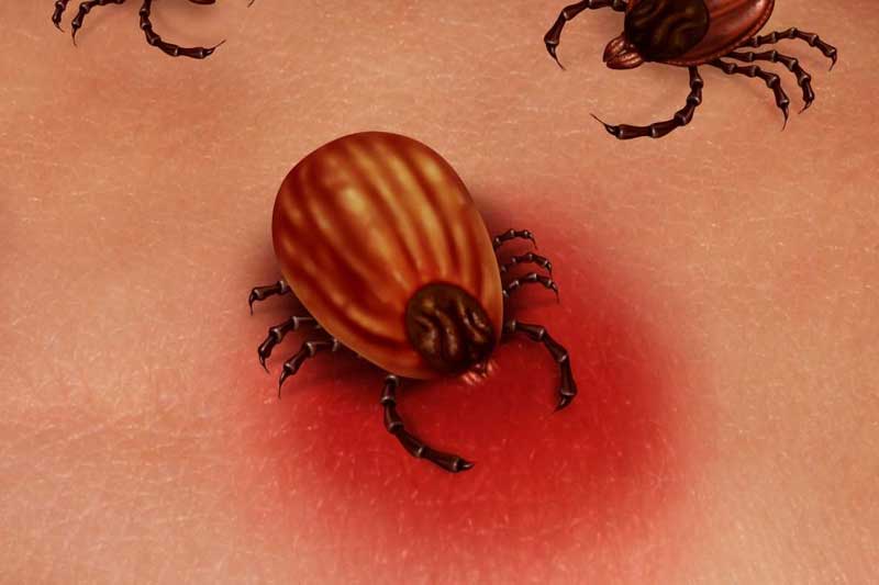 How Lyme Disease and Chronic Infections Can Lead to Cancer